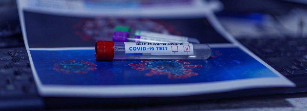 Antigen Test in Cozumel 